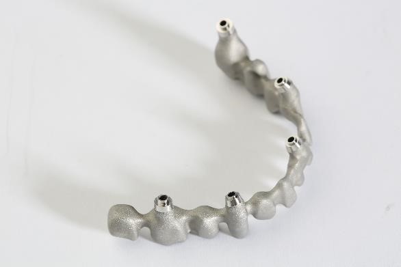 3D-Metalldruck-Anwendungen für patientenspezifische Zahnbrücken mit Nachbearbeitungslösungen fertiggestellt.