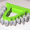 WorkNC Dental V3 - makes machining even more efficient
